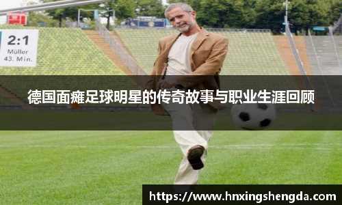 德国面瘫足球明星的传奇故事与职业生涯回顾